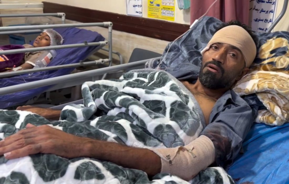 هنرمند اهل سیریک در جریان جنایت شب گذشته دشمن در سیریک مجروح شد
