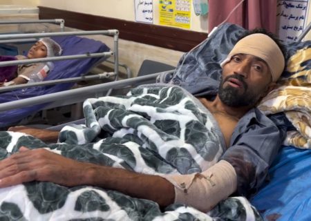 هنرمند اهل سیریک در جریان جنایت شب گذشته دشمن در سیریک مجروح شد